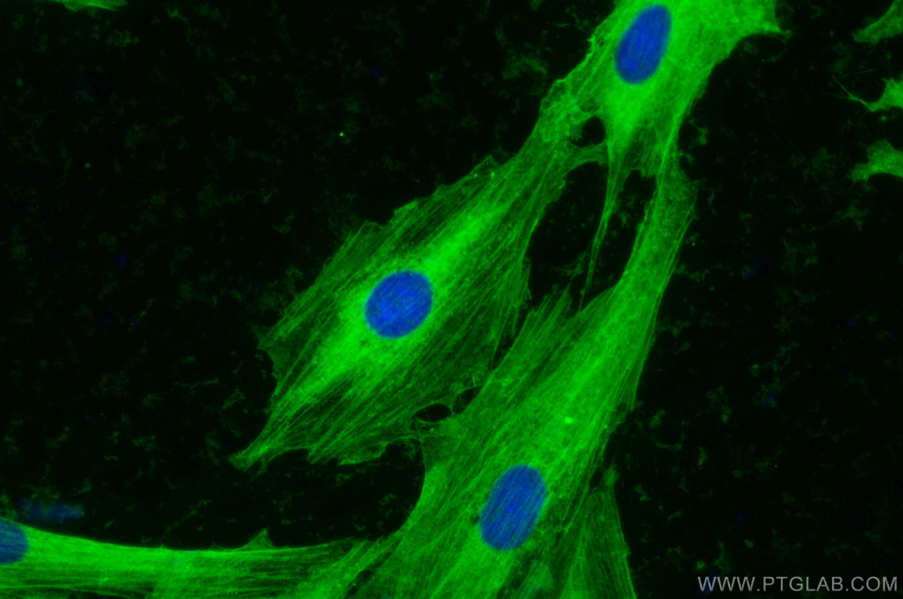 Immunofluorescence (IF) / fluorescent staining of H9C2 cells using Alpha Actin Polyclonal antibody (23660-1-AP)