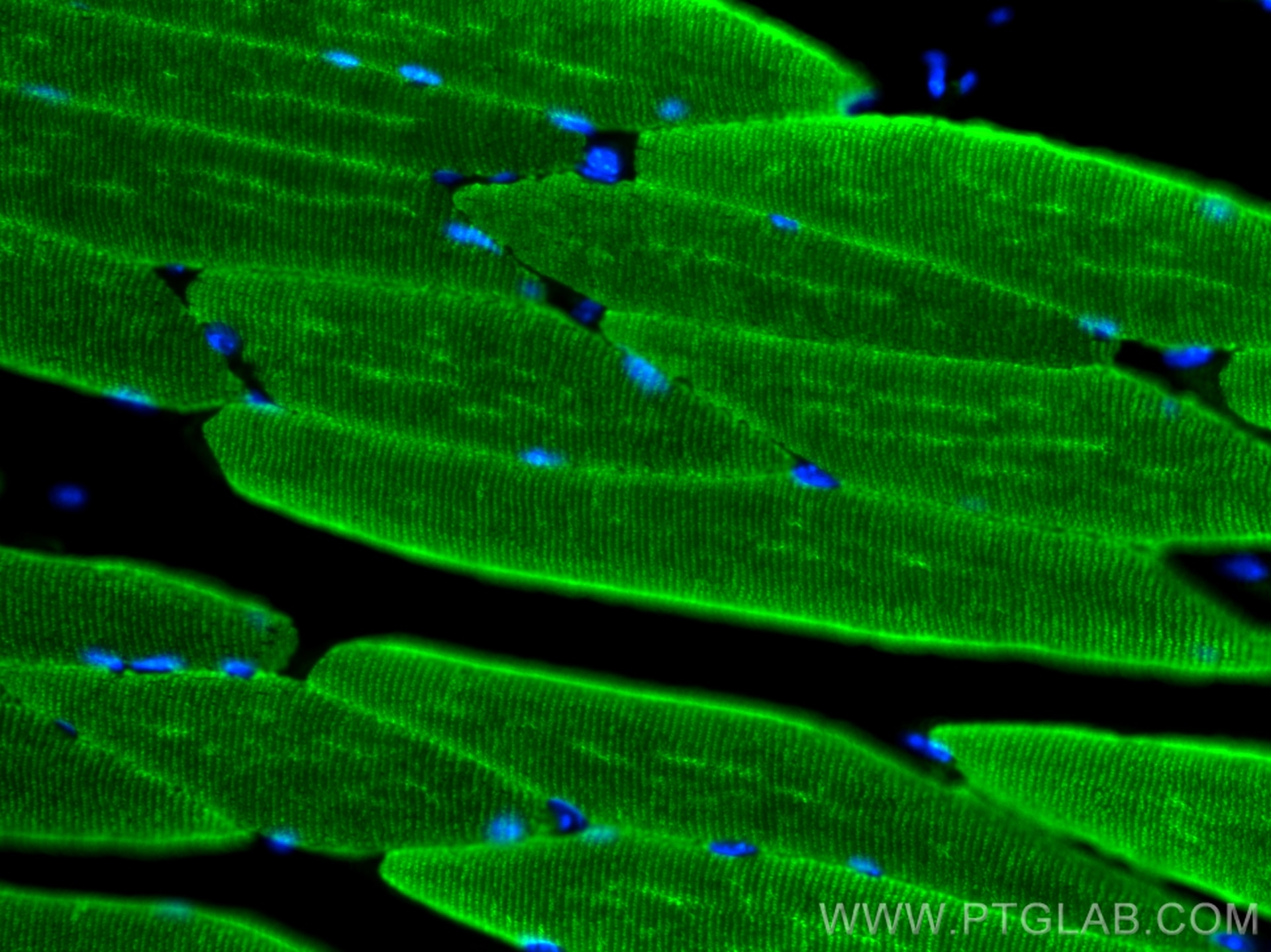 Immunofluorescence (IF) / fluorescent staining of mouse skeletal muscle tissue using Alpha Actin Polyclonal antibody (23660-1-AP)