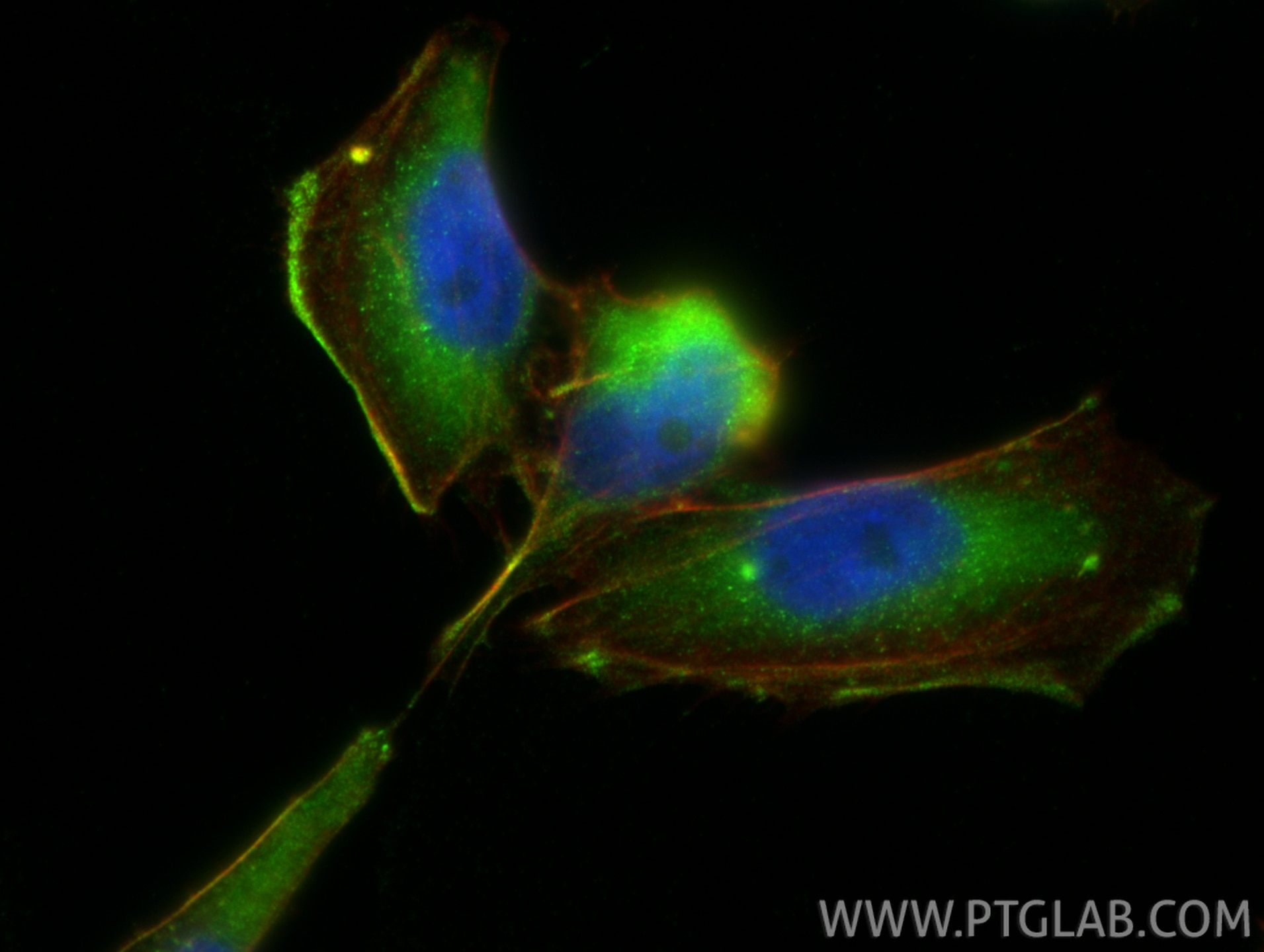 Immunofluorescence (IF) / fluorescent staining of AC16 cells using Alpha Actin Polyclonal antibody (23660-1-AP)