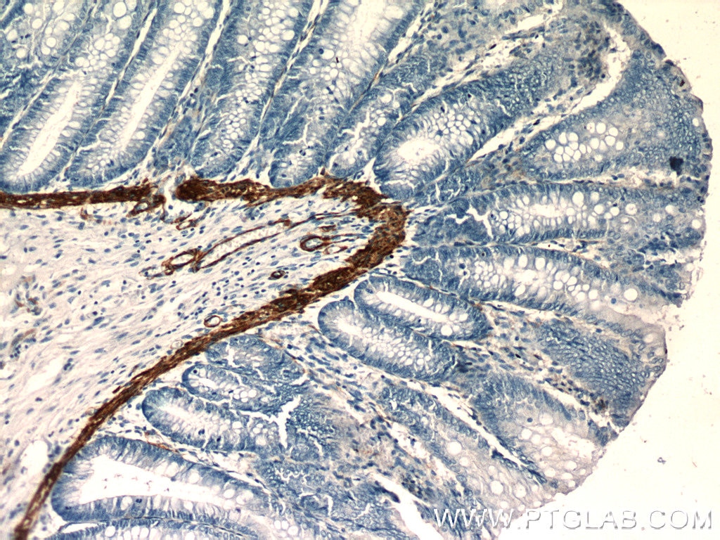 Immunohistochemistry (IHC) staining of human colon tissue using Alpha Actin Polyclonal antibody (23660-1-AP)