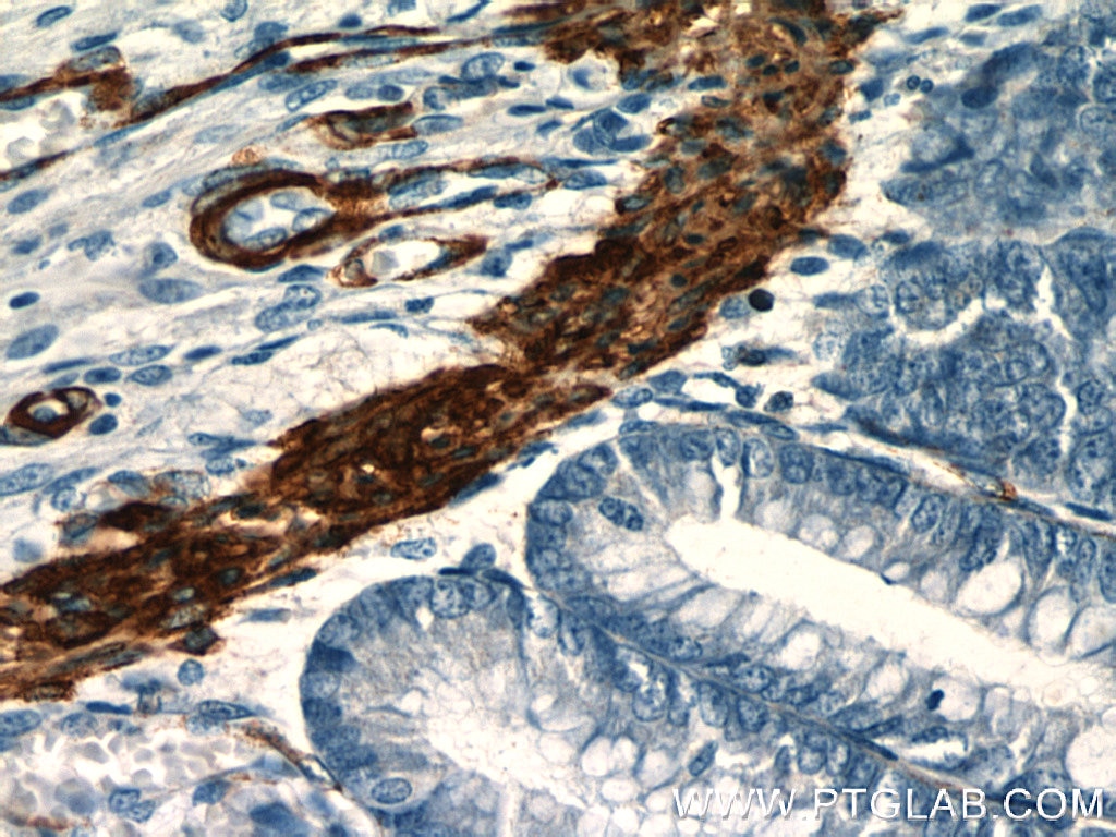 Immunohistochemistry (IHC) staining of human colon tissue using Alpha Actin Polyclonal antibody (23660-1-AP)