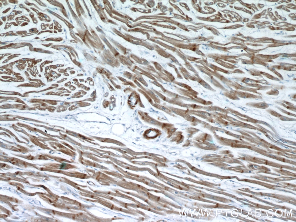 Immunohistochemistry (IHC) staining of human heart tissue using Alpha Actin Polyclonal antibody (23660-1-AP)