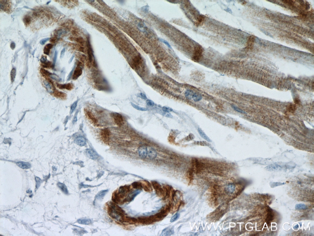 Immunohistochemistry (IHC) staining of human heart tissue using Alpha Actin Polyclonal antibody (23660-1-AP)