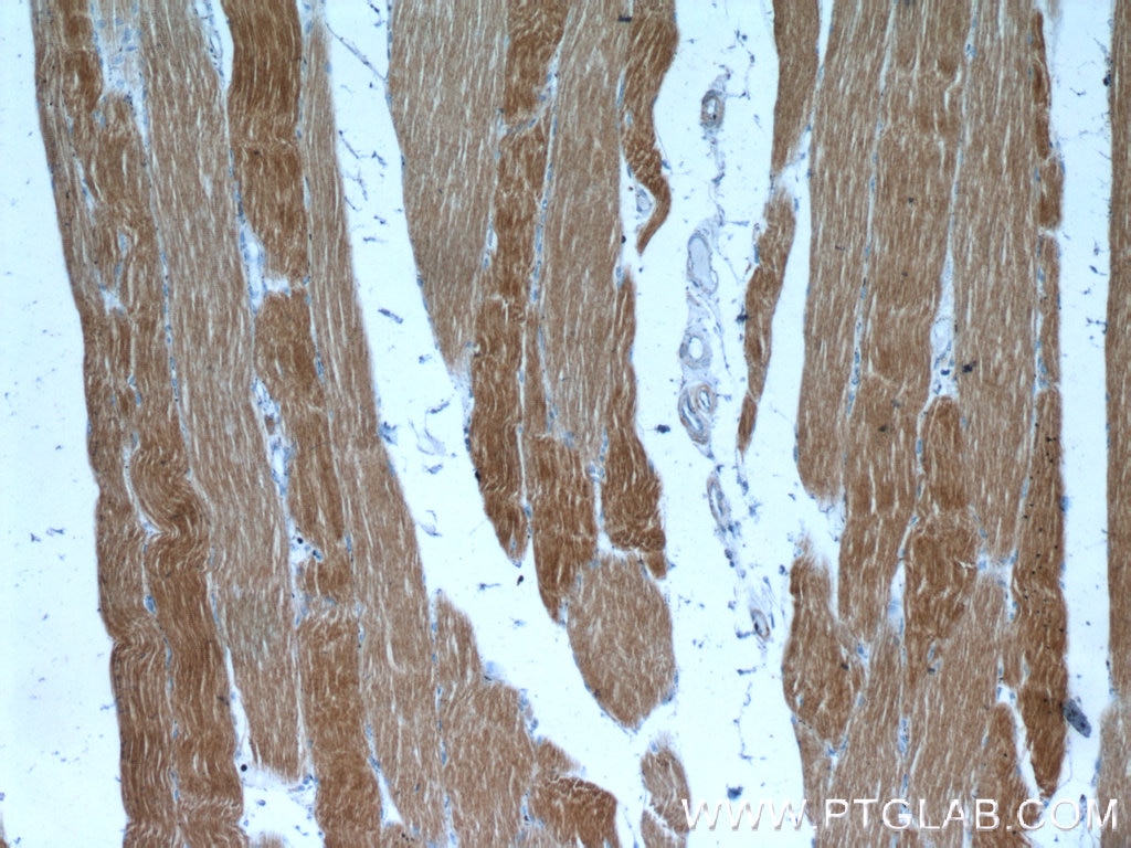 Immunohistochemistry (IHC) staining of human skeletal muscle tissue using Alpha Actin Polyclonal antibody (23660-1-AP)