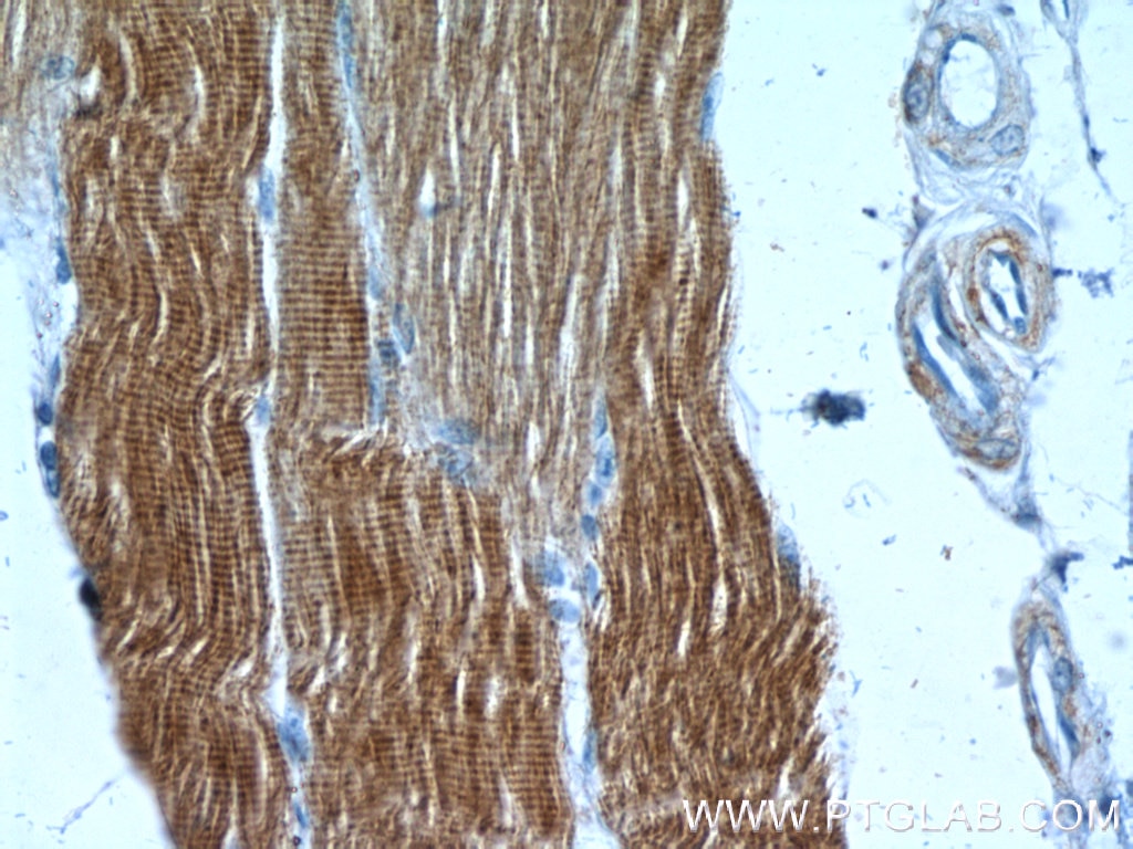 IHC staining of human skeletal muscle using 23660-1-AP