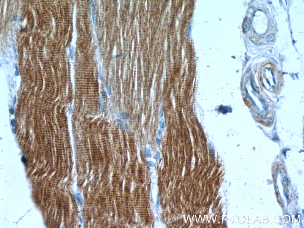 Immunohistochemistry (IHC) staining of human skeletal muscle tissue using Alpha Actin Polyclonal antibody (23660-1-AP)