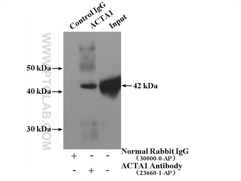 Immunoprecipitation (IP) experiment of mouse skeletal muscle tissue using Alpha Actin Polyclonal antibody (23660-1-AP)
