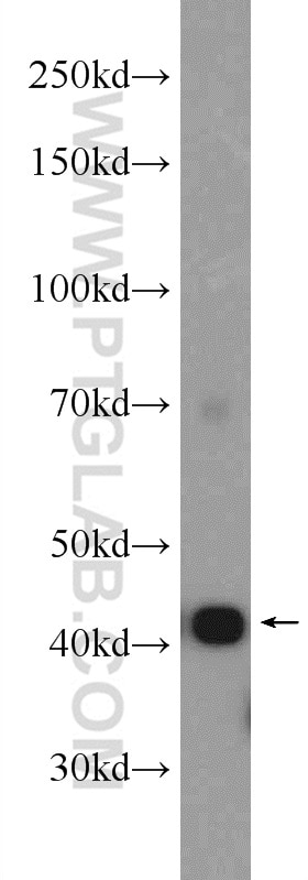 Western Blot (WB) analysis of rat skeletal muscle tissue using Alpha Actin Polyclonal antibody (23660-1-AP)