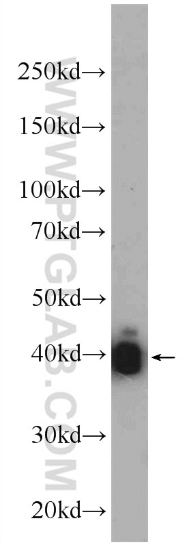 Western Blot (WB) analysis of mouse skeletal muscle tissue using Alpha Actin Polyclonal antibody (23660-1-AP)