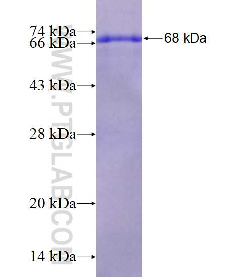 ACTA1 fusion protein Ag19151 SDS-PAGE
