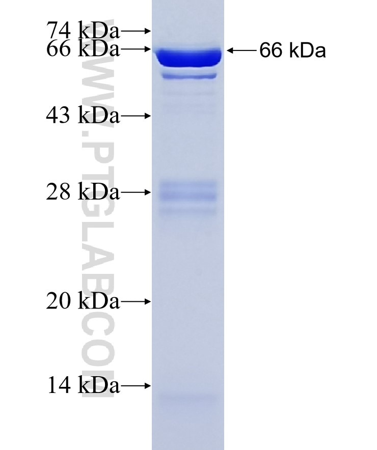 ACTA1 fusion protein Ag19151 SDS-PAGE