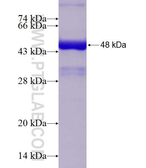ACTA1 fusion protein Ag20271 SDS-PAGE