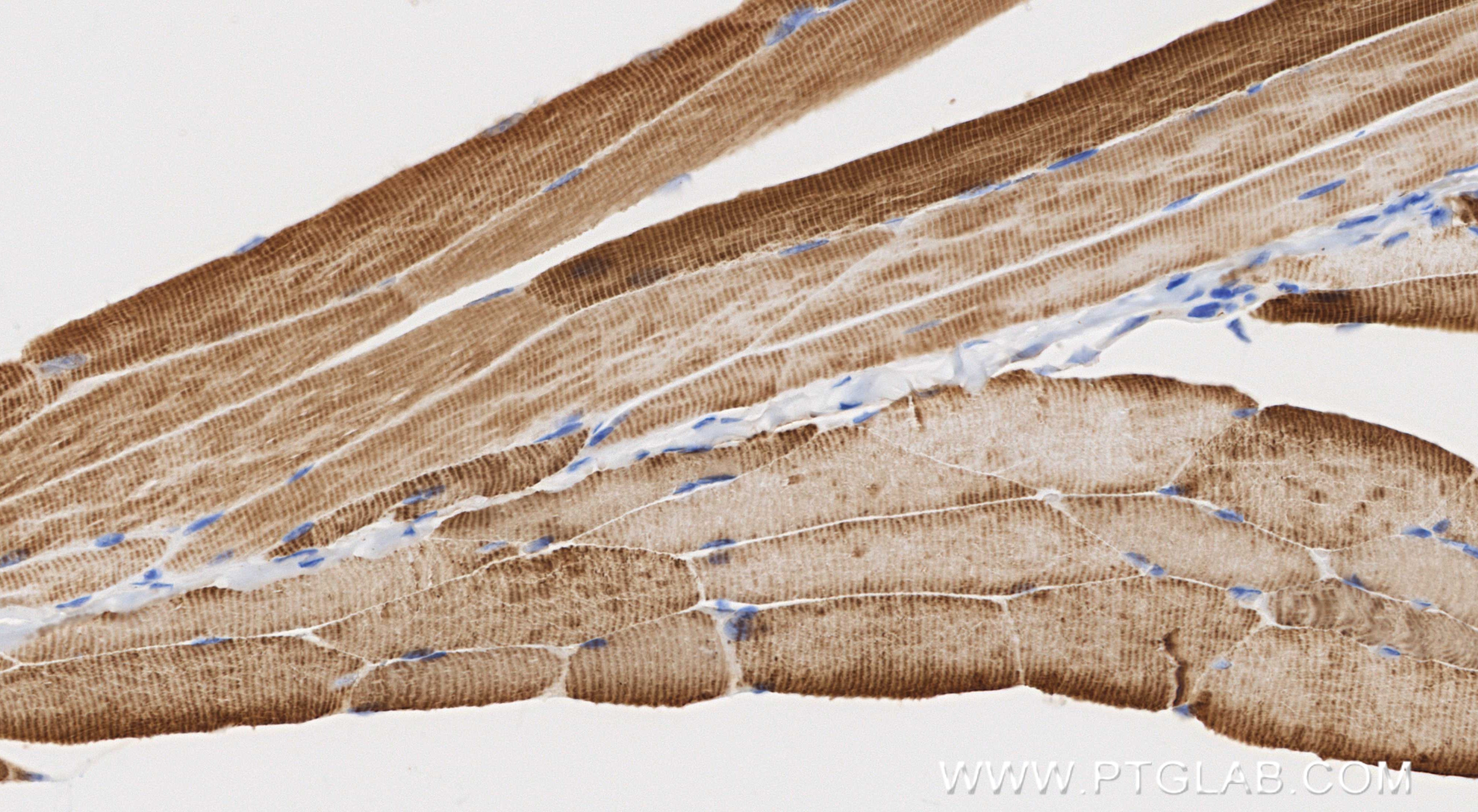Immunohistochemical analysis of paraffin-embedded mouse skeletal muscle tissue slide using 82714-5-RR (ACTA1-Specific antibody) at dilution of 1:1000 (under 40x lens). Heat mediated antigen retrieval with Tris-EDTA buffer (pH 9.0). This data was developed using the same antibody clone with 82714-5-PBS in a different storage buffer formulation. Immunohistochemistry (IHC) staining of mouse skeletal muscle tissue using ACTA1-Specific Recombinant monoclonal antibody (82714-5-RR)