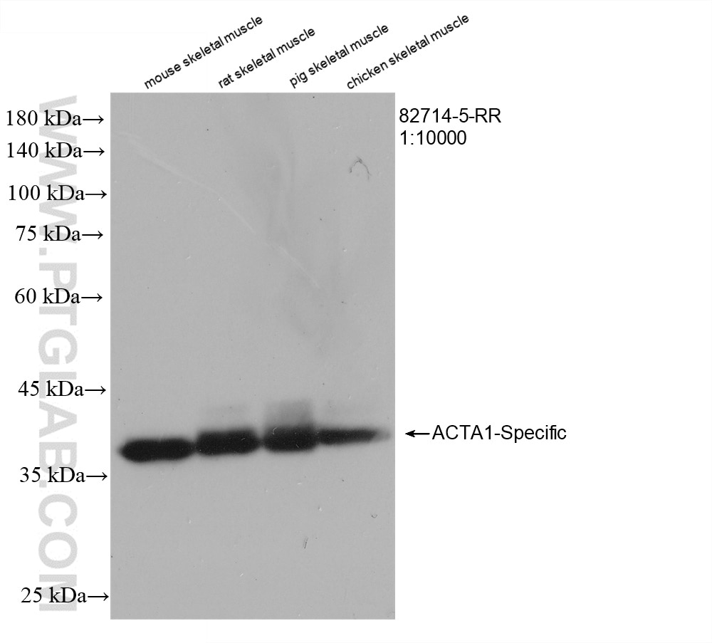 Western Blot (WB) analysis of various lysates using ACTA1-Specific Recombinant antibody (82714-5-RR)