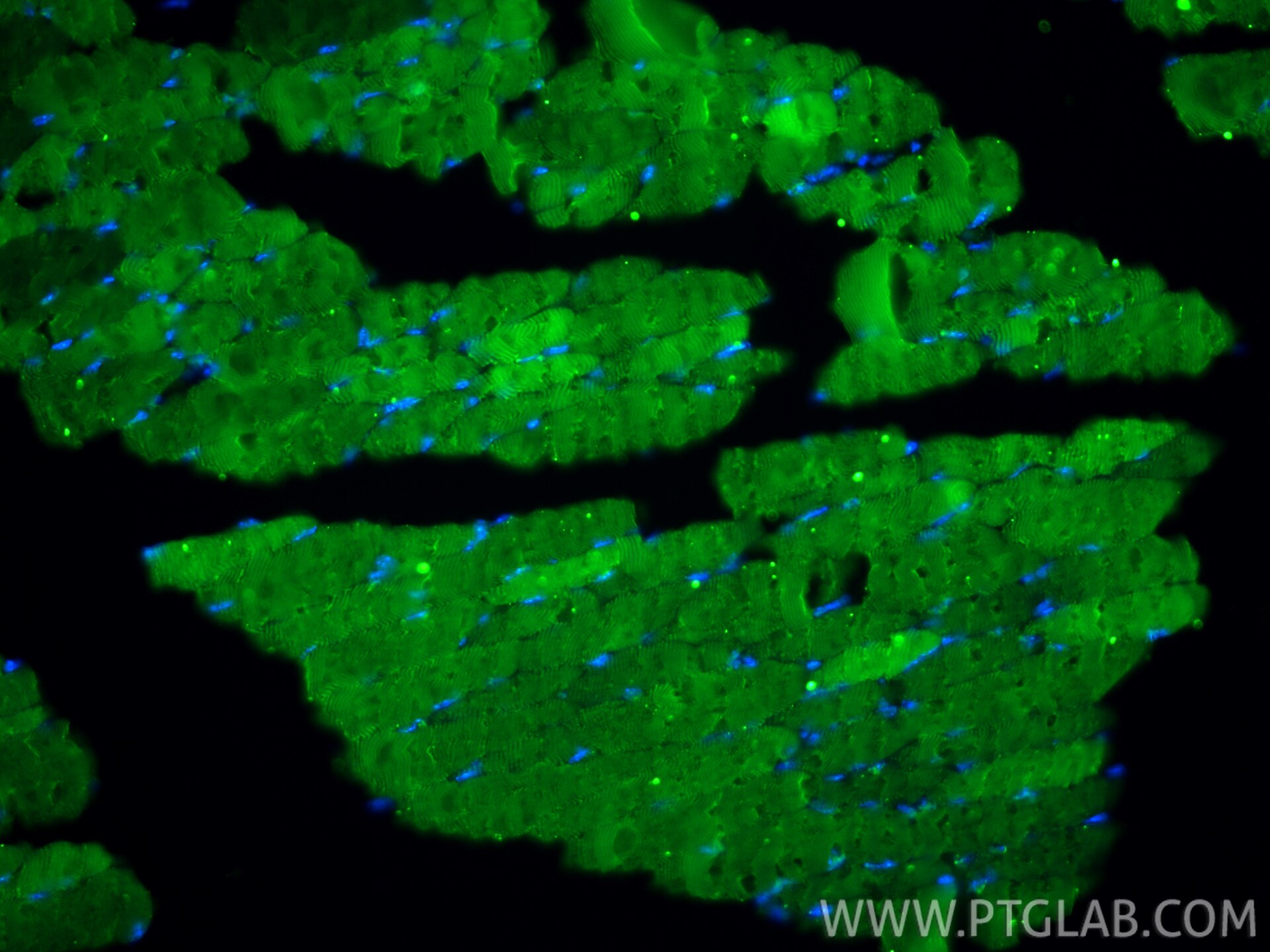 Immunofluorescence (IF) / fluorescent staining of mouse skeletal muscle tissue using CoraLite® Plus 488-conjugated ACTA1-Specific Recom (CL488-82714-5)