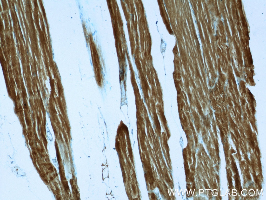 Immunohistochemistry (IHC) staining of human skeletal muscle tissue using ACTA1-Specific Polyclonal antibody (17521-1-AP)