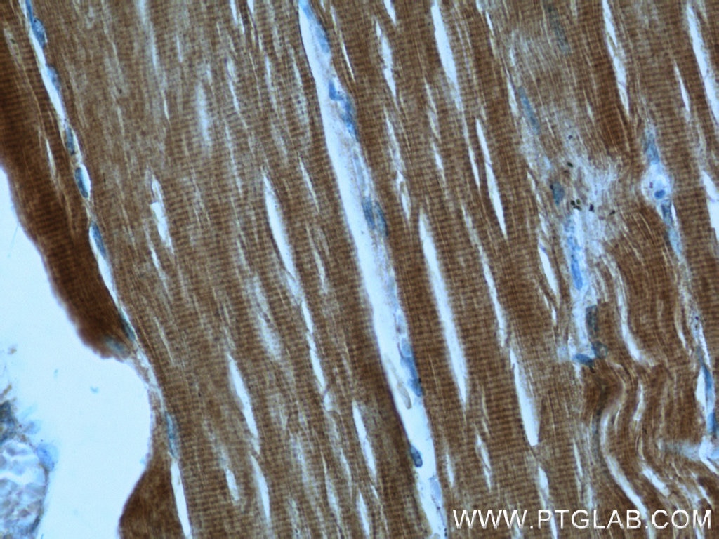 Immunohistochemistry (IHC) staining of human skeletal muscle tissue using ACTA1-Specific Polyclonal antibody (17521-1-AP)