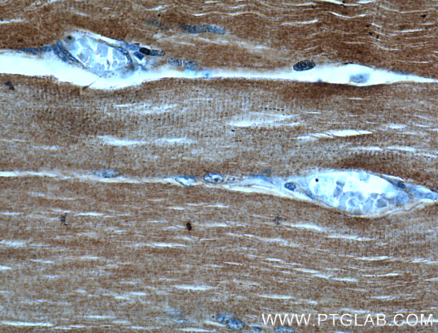 Immunohistochemistry (IHC) staining of human skeletal muscle tissue using ACTA1-Specific Polyclonal antibody (17521-1-AP)