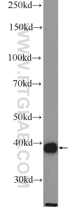 Western Blot (WB) analysis of rat skeletal muscle tissue using ACTA1-Specific Polyclonal antibody (17521-1-AP)