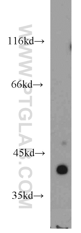 Western Blot (WB) analysis of human skeletal muscle tissue using ACTA1-Specific Polyclonal antibody (17521-1-AP)