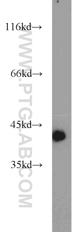 Western Blot (WB) analysis of mouse skeletal muscle tissue using ACTA1-Specific Polyclonal antibody (17521-1-AP)