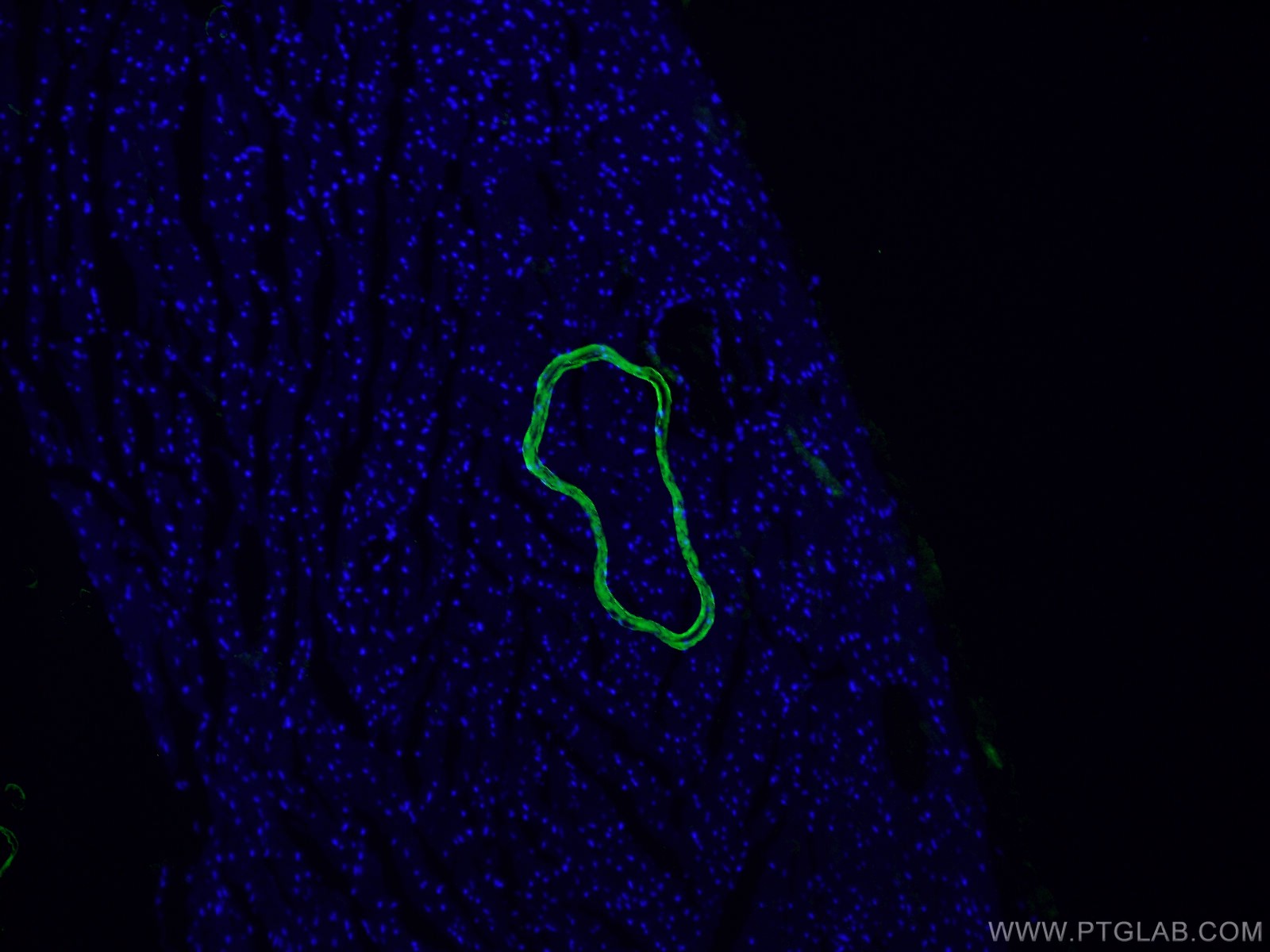Immunofluorescence (IF) / fluorescent staining of mouse heart tissue using smooth muscle actin Polyclonal antibody (14395-1-AP)
