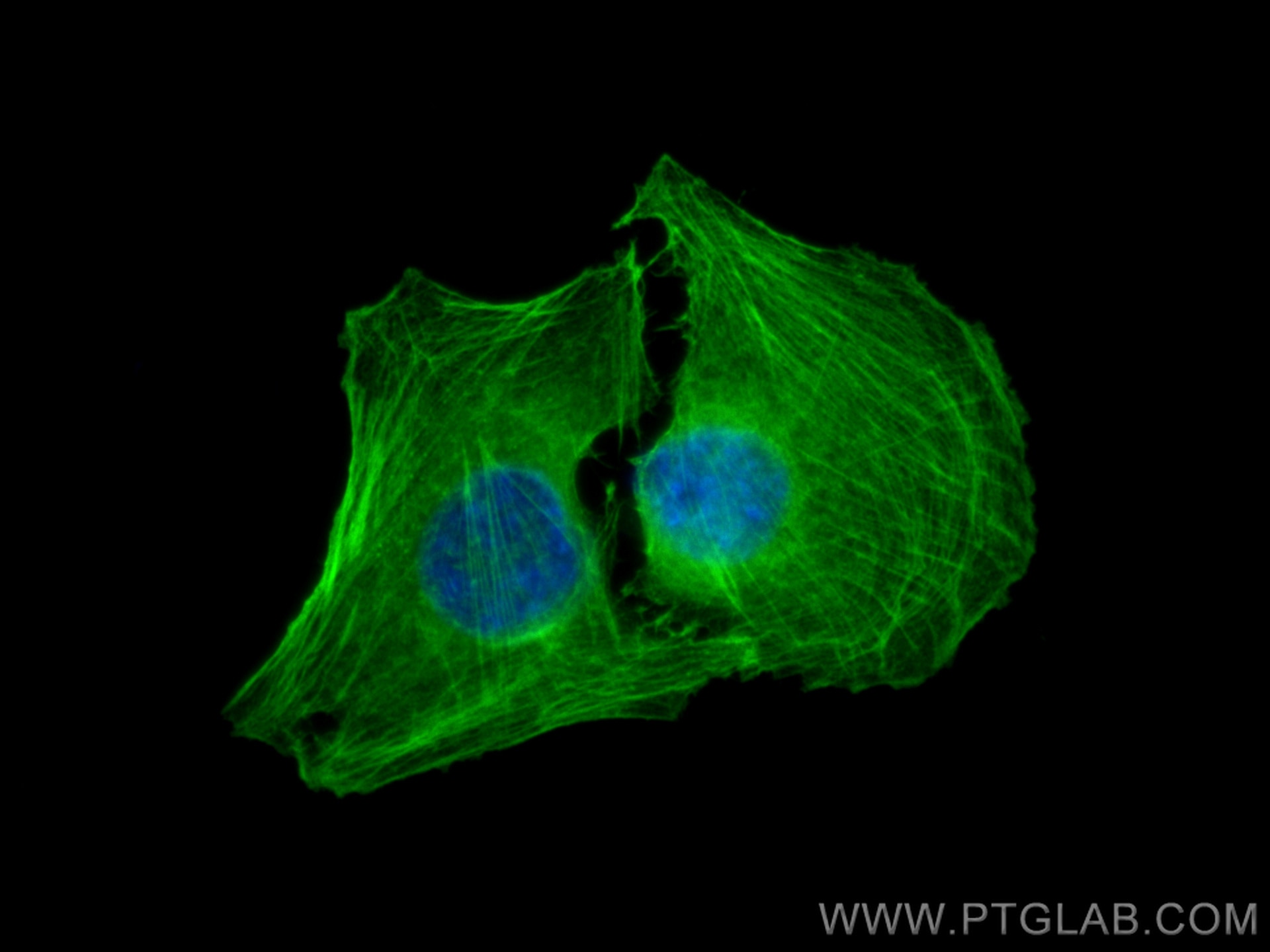 Immunofluorescence (IF) / fluorescent staining of C2C12 cells using smooth muscle actin Polyclonal antibody (14395-1-AP)