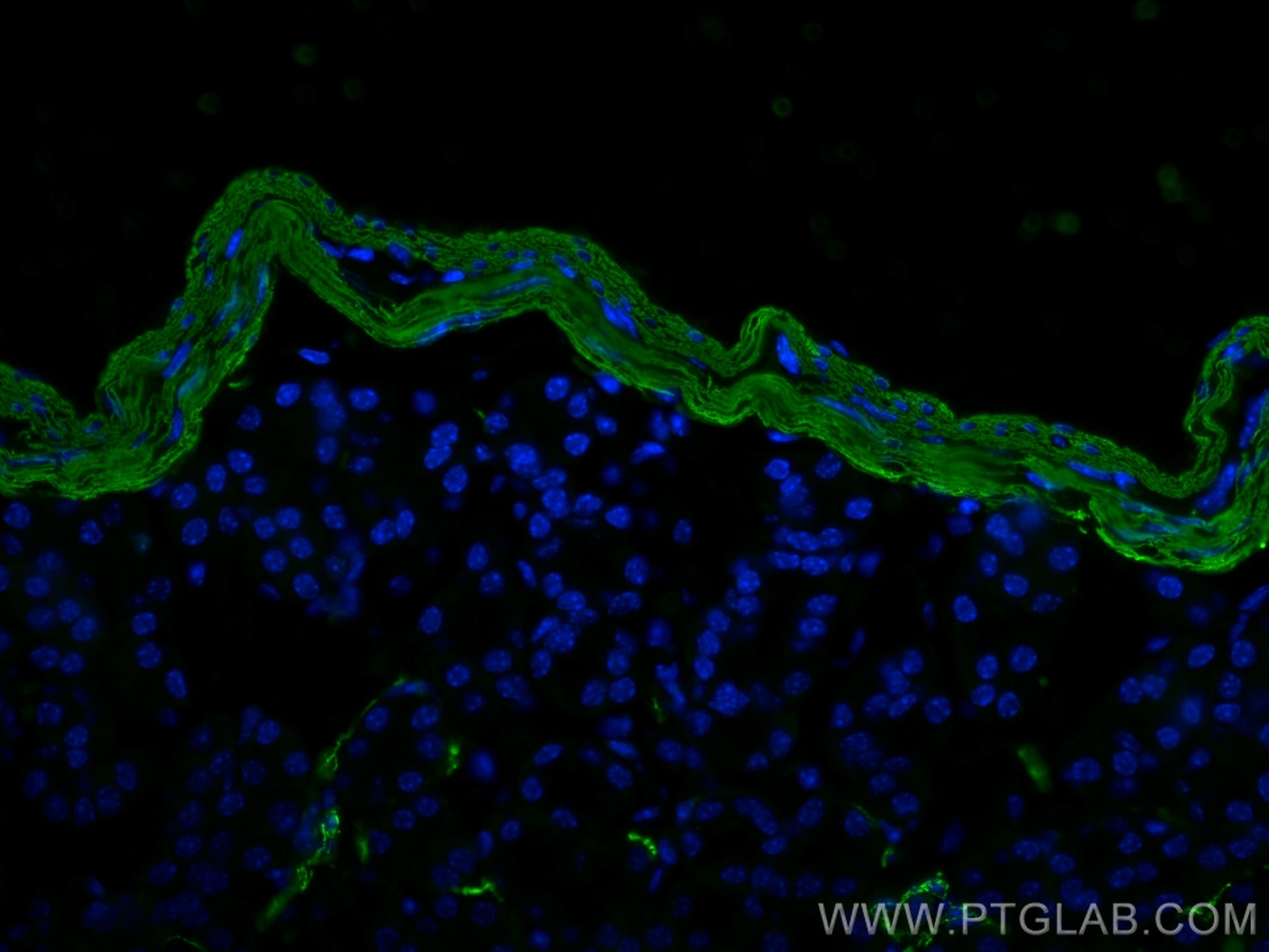 Immunofluorescence (IF) / fluorescent staining of mouse small intestine tissue using smooth muscle actin Polyclonal antibody (14395-1-AP)