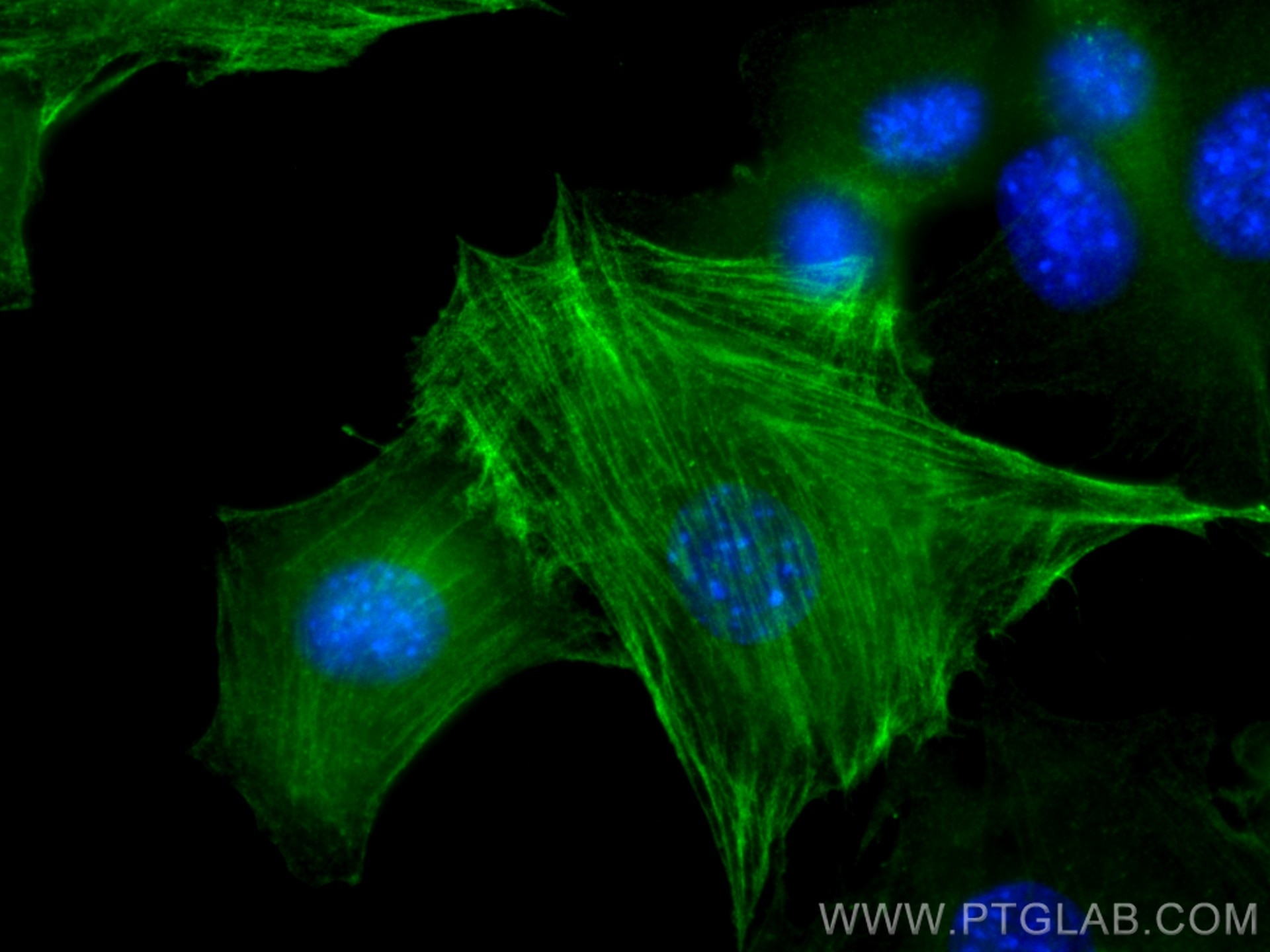 Immunofluorescence (IF) / fluorescent staining of C2C12 cells using smooth muscle actin Polyclonal antibody (14395-1-AP)