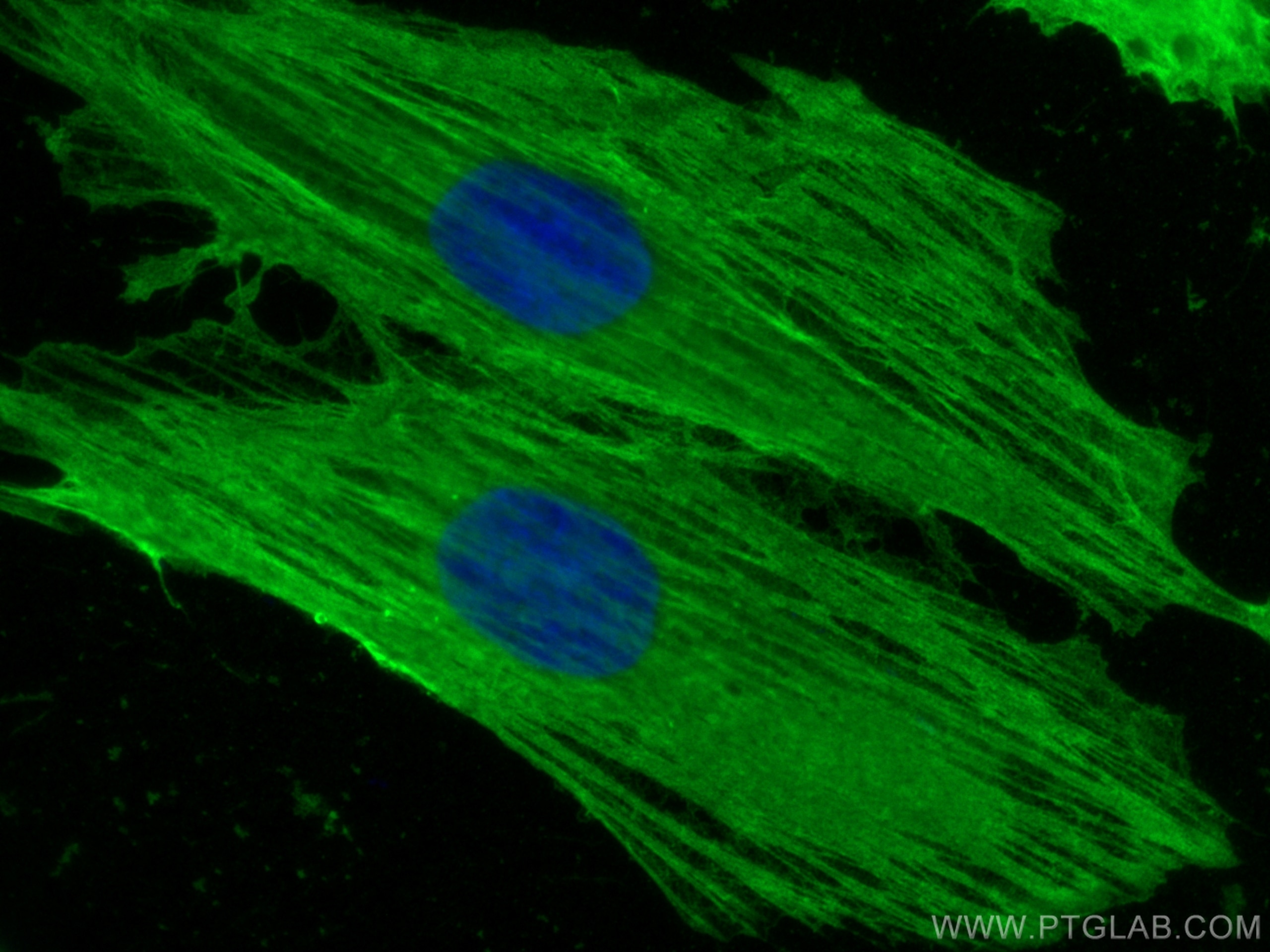 Immunofluorescence (IF) / fluorescent staining of H9C2 cells using smooth muscle actin Polyclonal antibody (14395-1-AP)