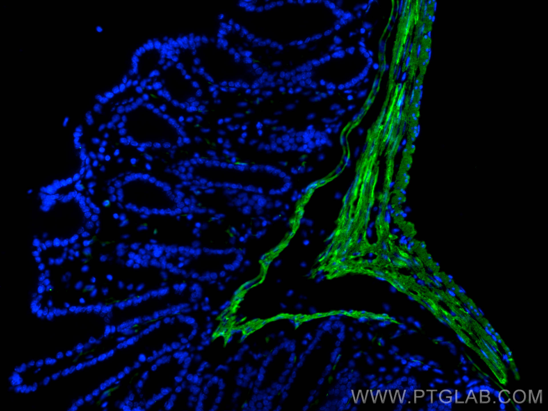 Immunofluorescence (IF) / fluorescent staining of mouse colon tissue using Alpha smooth muscle actin Polyclonal antibody (14395-1-AP)