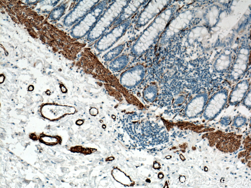 IHC staining of human colon using 14395-1-AP