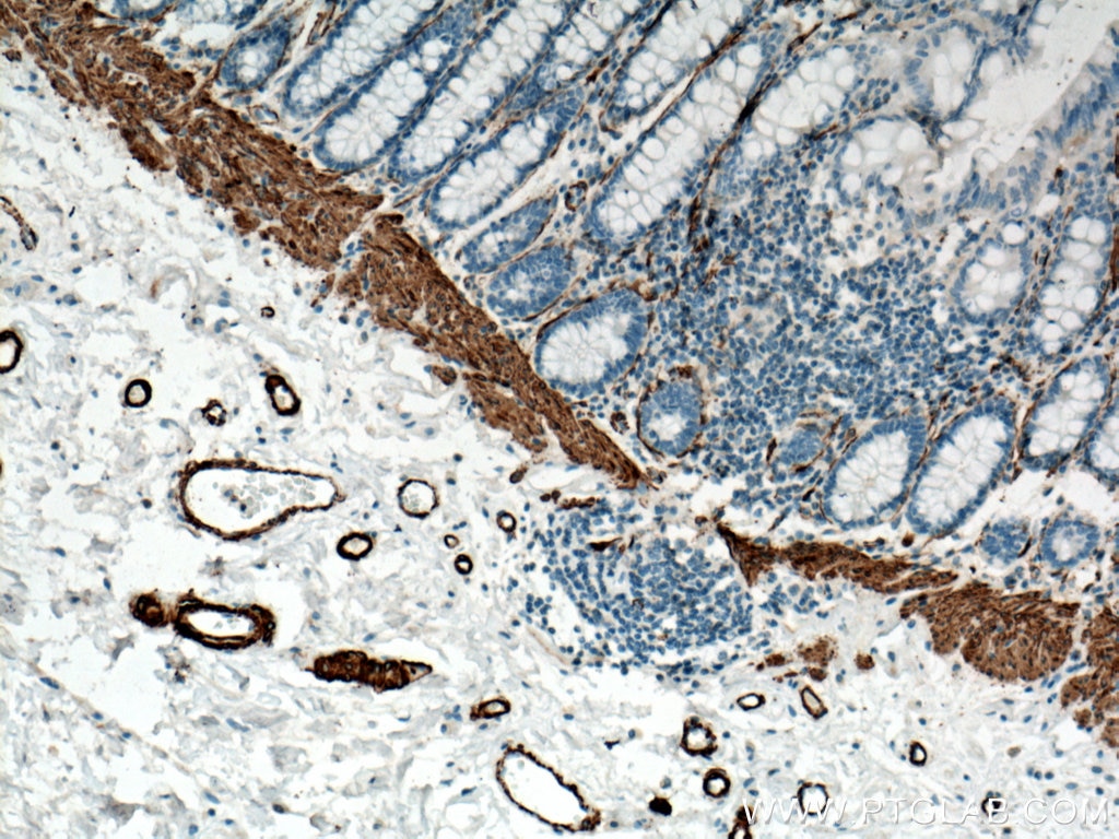 Immunohistochemistry (IHC) staining of human colon tissue using smooth muscle actin Polyclonal antibody (14395-1-AP)