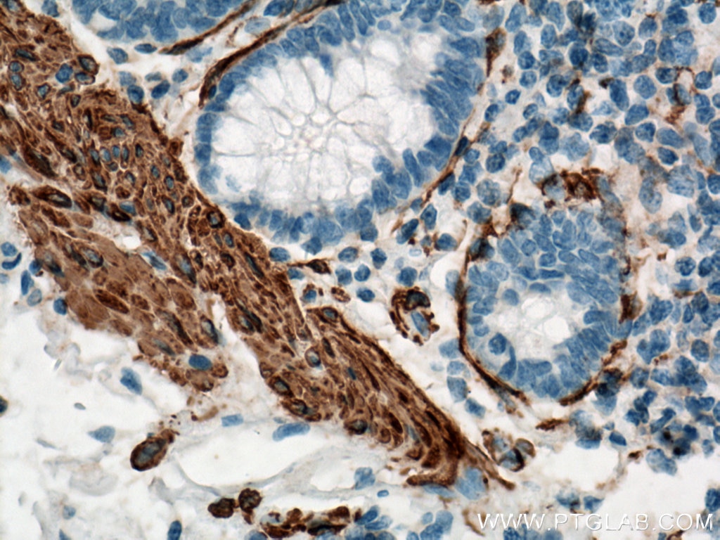 Immunohistochemistry (IHC) staining of human colon tissue using smooth muscle actin Polyclonal antibody (14395-1-AP)