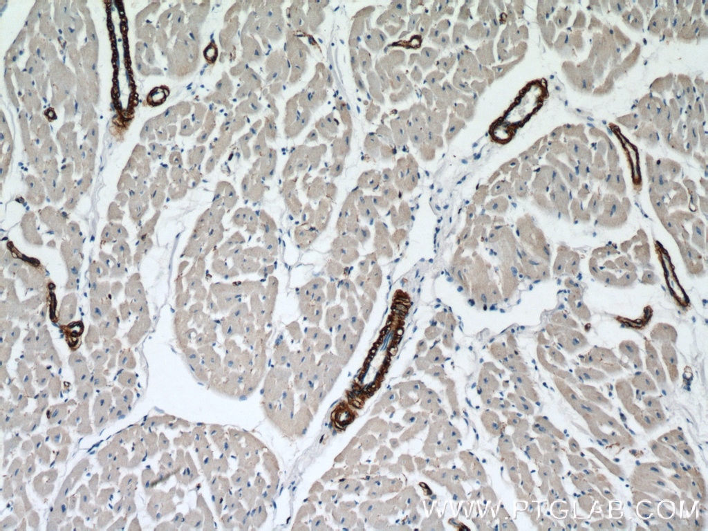 Immunohistochemistry (IHC) staining of human heart tissue using smooth muscle actin Polyclonal antibody (14395-1-AP)