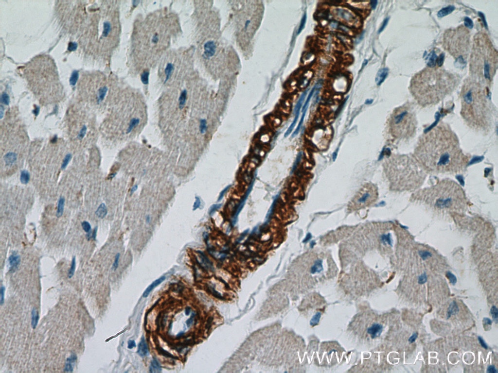 Immunohistochemistry (IHC) staining of human heart tissue using smooth muscle actin Polyclonal antibody (14395-1-AP)
