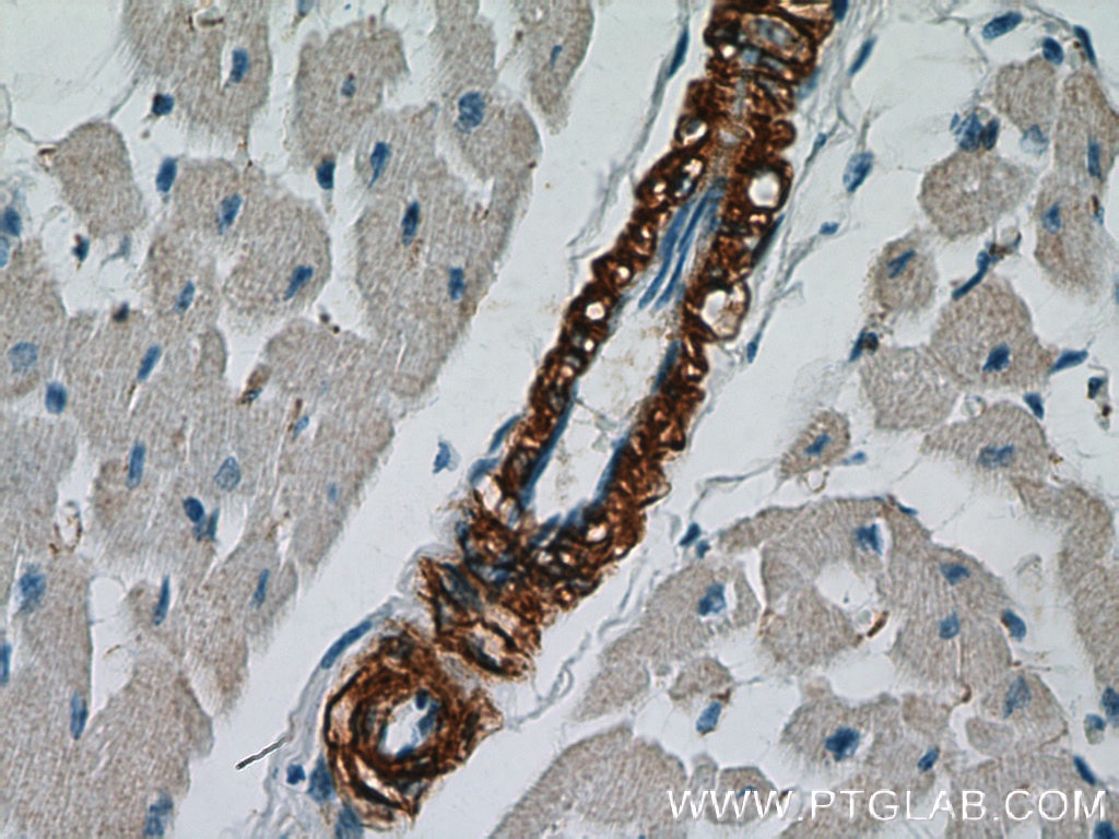 IHC staining of human heart using 14395-1-AP