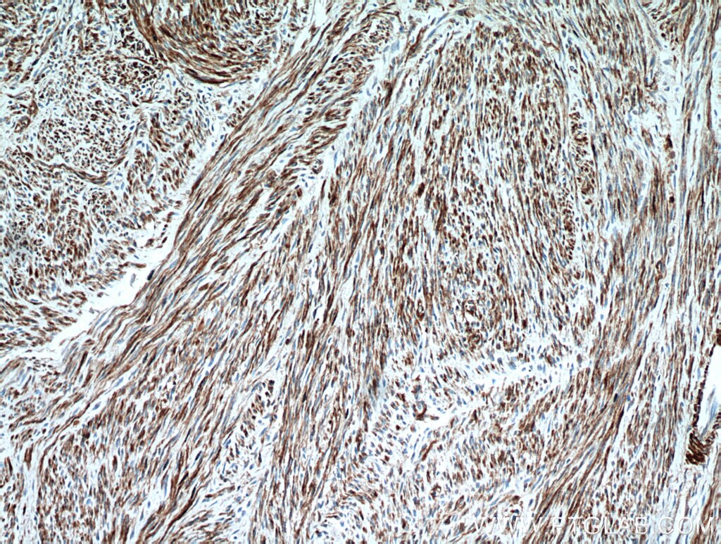 smooth muscle actin Polyclonal antibody