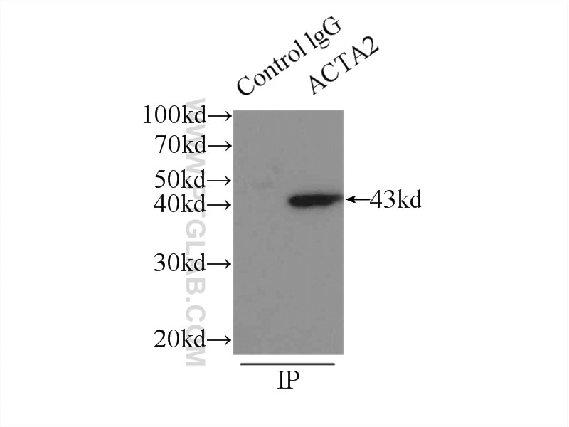 Immunoprecipitation (IP) experiment of mouse liver tissue using smooth muscle actin Polyclonal antibody (14395-1-AP)