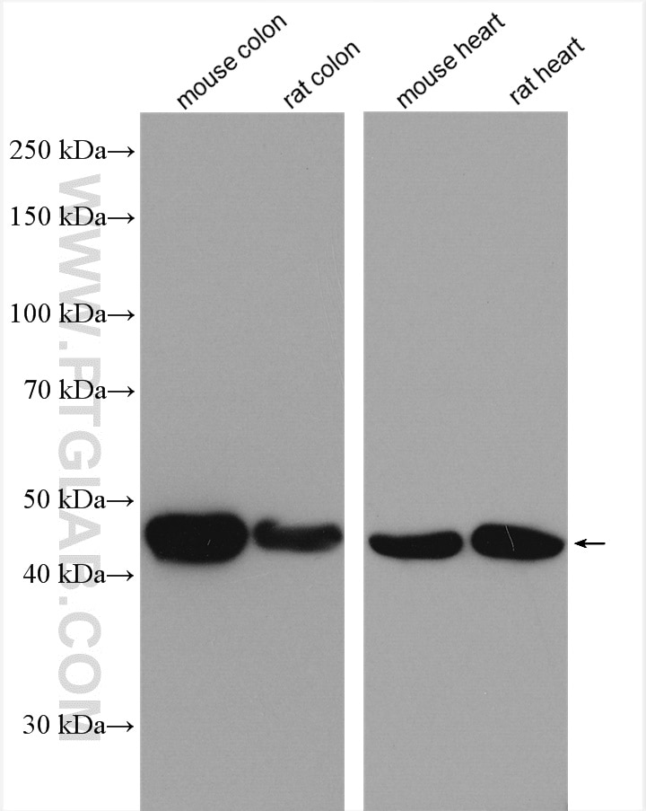 Western Blot (WB) analysis of various lysates using smooth muscle actin Polyclonal antibody (14395-1-AP)