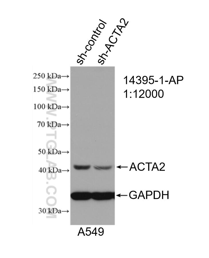 Western Blot (WB) analysis of A549 cells using smooth muscle actin Polyclonal antibody (14395-1-AP)