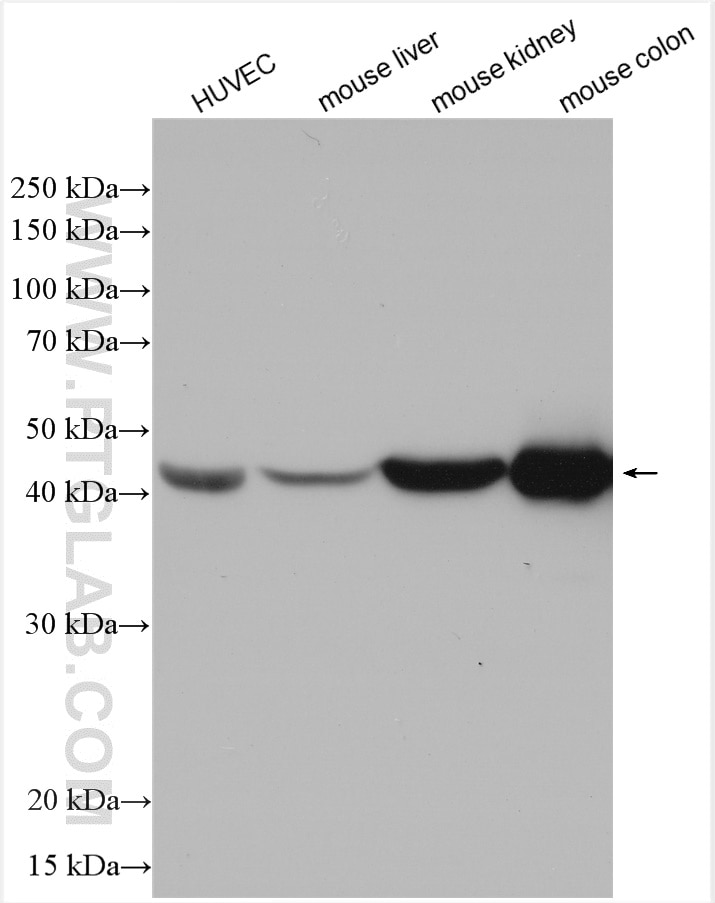 Western Blot (WB) analysis of various lysates using smooth muscle actin Polyclonal antibody (14395-1-AP)