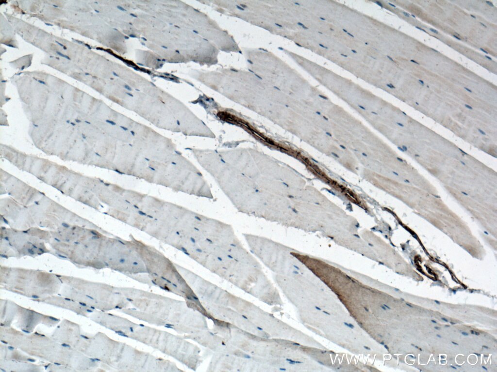 Immunohistochemistry (IHC) staining of mouse skeletal muscle tissue using smooth muscle actin Polyclonal antibody (23081-1-AP)