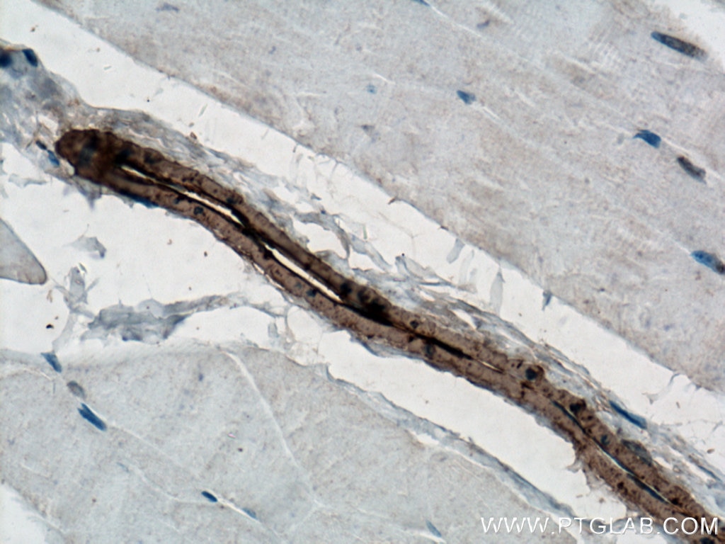 Immunohistochemistry (IHC) staining of mouse skeletal muscle tissue using smooth muscle actin Polyclonal antibody (23081-1-AP)