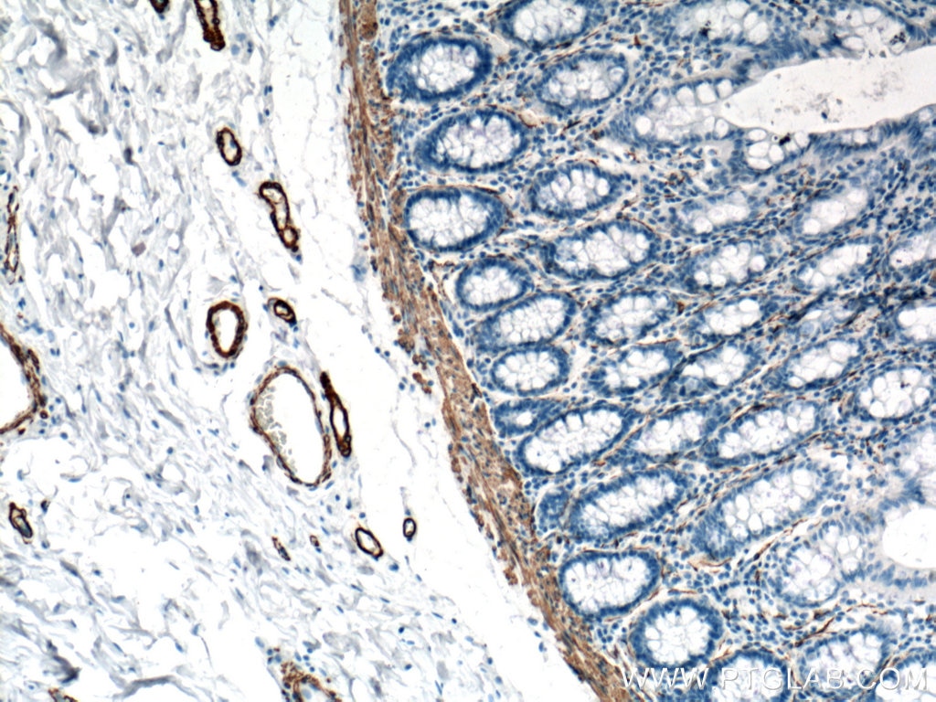 Immunohistochemistry (IHC) staining of human colon tissue using smooth muscle actin Polyclonal antibody (23081-1-AP)