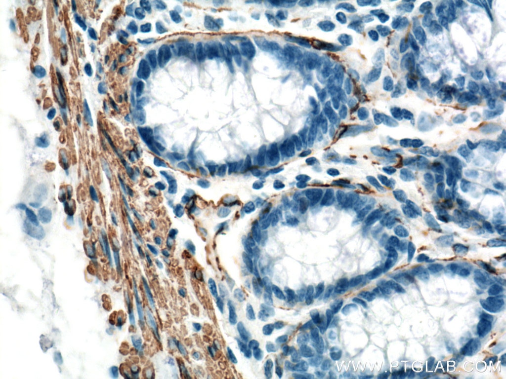 Immunohistochemistry (IHC) staining of human colon tissue using smooth muscle actin Polyclonal antibody (23081-1-AP)