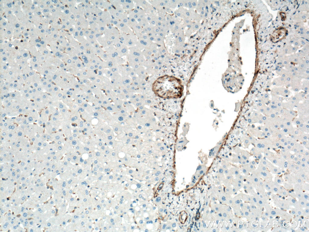 Immunohistochemistry (IHC) staining of human liver tissue using smooth muscle actin Polyclonal antibody (23081-1-AP)