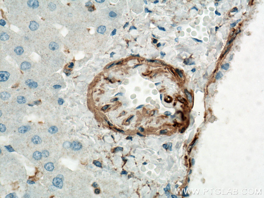Immunohistochemistry (IHC) staining of human liver tissue using smooth muscle actin Polyclonal antibody (23081-1-AP)