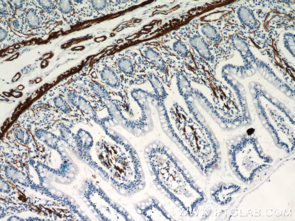 Immunohistochemistry (IHC) staining of human small intestine tissue using smooth muscle actin Polyclonal antibody (23081-1-AP)