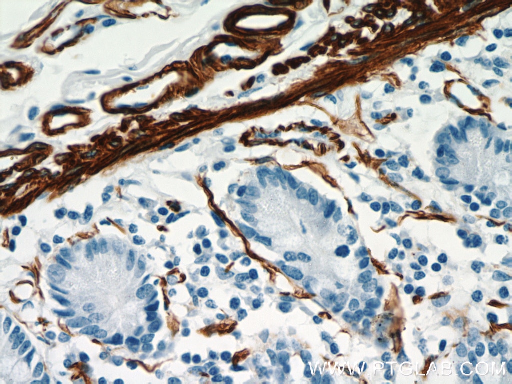 Immunohistochemistry (IHC) staining of human small intestine tissue using smooth muscle actin Polyclonal antibody (23081-1-AP)